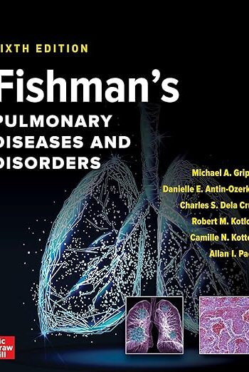 Best Selling 81cdmss2el. sy522 .jpg